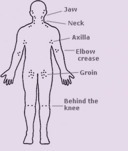 lymph-nodes-diagram